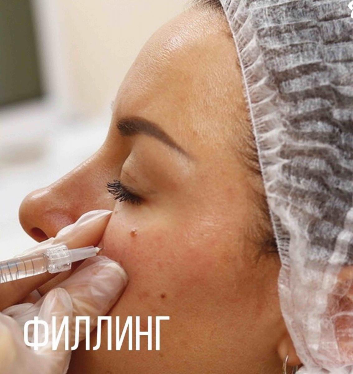 ФИЛЛИНГ СКУЛ ФИЛЛИНГ СКУЛ